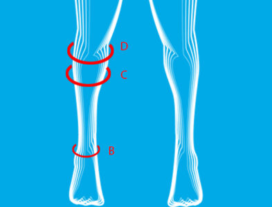 knee socks